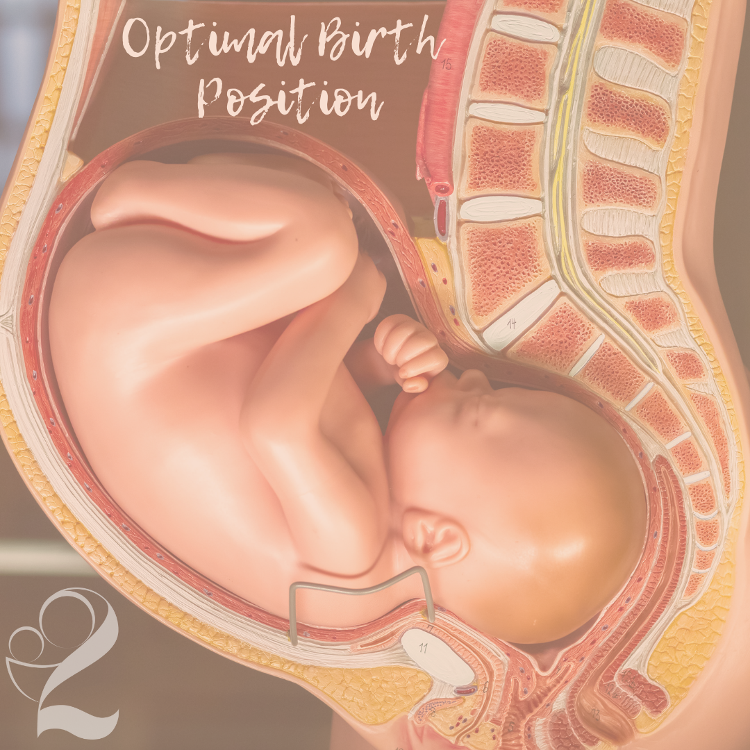 Read more about the article Optimal Fetal Positioning