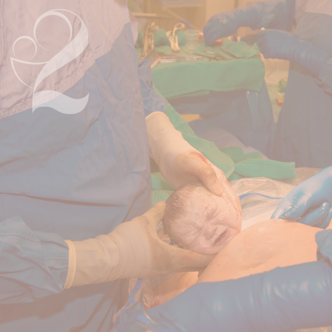 Read more about the article What is a Family-Centered C-Section? Do I Still Have Options?
